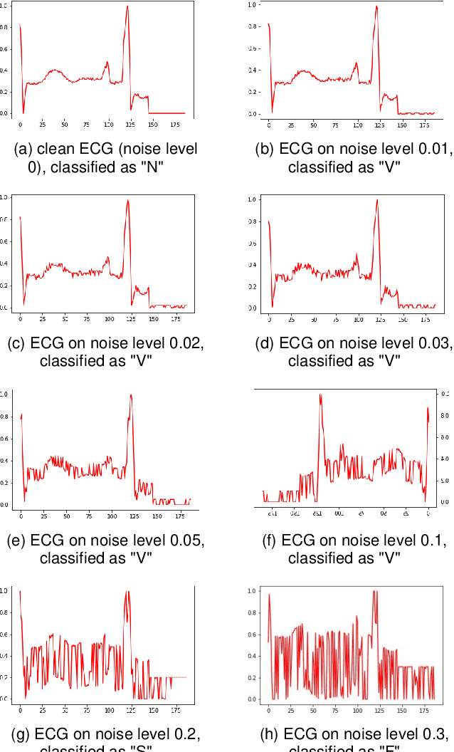 Figure 4 for A Regularization Method to Improve Adversarial Robustness of Neural Networks for ECG Signal Classification