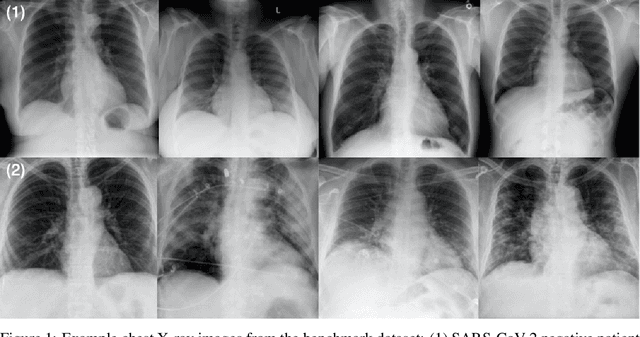 Figure 1 for COVID-Net CXR-2: An Enhanced Deep Convolutional Neural Network Design for Detection of COVID-19 Cases from Chest X-ray Images