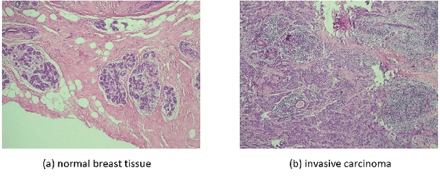 Figure 1 for Discriminative Pattern Mining for Breast Cancer Histopathology Image Classification via Fully Convolutional Autoencoder