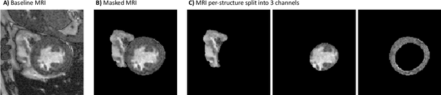 Figure 3 for Federated Learning for Multi-Center Imaging Diagnostics: A Study in Cardiovascular Disease