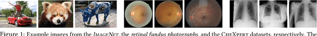 Figure 1 for Transfusion: Understanding Transfer Learning with Applications to Medical Imaging