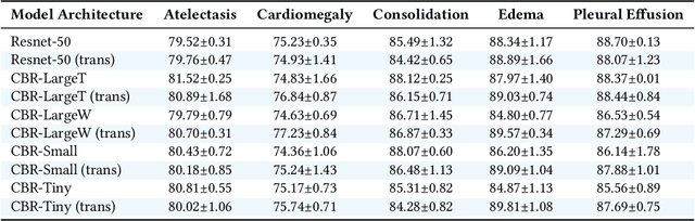 Figure 3 for Transfusion: Understanding Transfer Learning with Applications to Medical Imaging