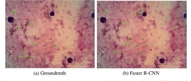 Figure 2 for Localization of Malaria Parasites and White Blood Cells in Thick Blood Smears