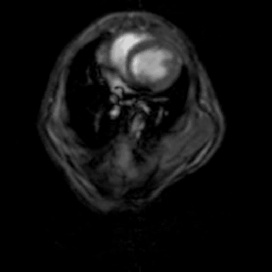 Figure 3 for Live-wire 3D medical images segmentation