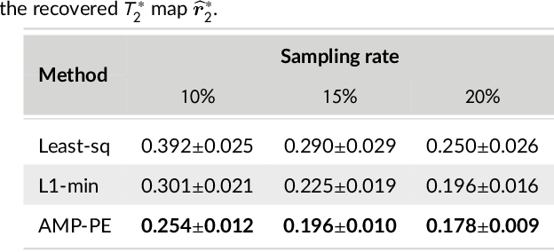 Figure 2 for A Bayesian approach for $T_2^*$ Mapping and Quantitative Susceptibility Mapping