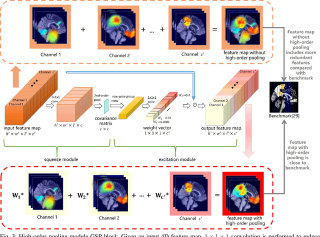Figure 4 for Tensorizing GAN with High-Order Pooling for Alzheimer's Disease Assessment