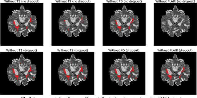 Figure 3 for A Self-Adaptive Network For Multiple Sclerosis Lesion Segmentation From Multi-Contrast MRI With Various Imaging Protocols