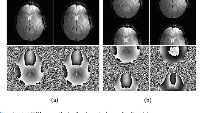 Figure 1 for Navigator-free EPI Ghost Correction with Structured Low-Rank Matrix Models: New Theory and Methods