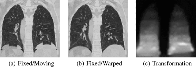 Figure 3 for AirLab: Autograd Image Registration Laboratory