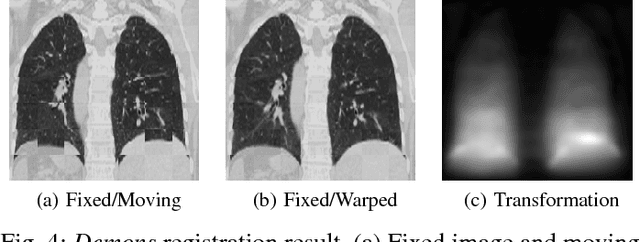 Figure 4 for AirLab: Autograd Image Registration Laboratory