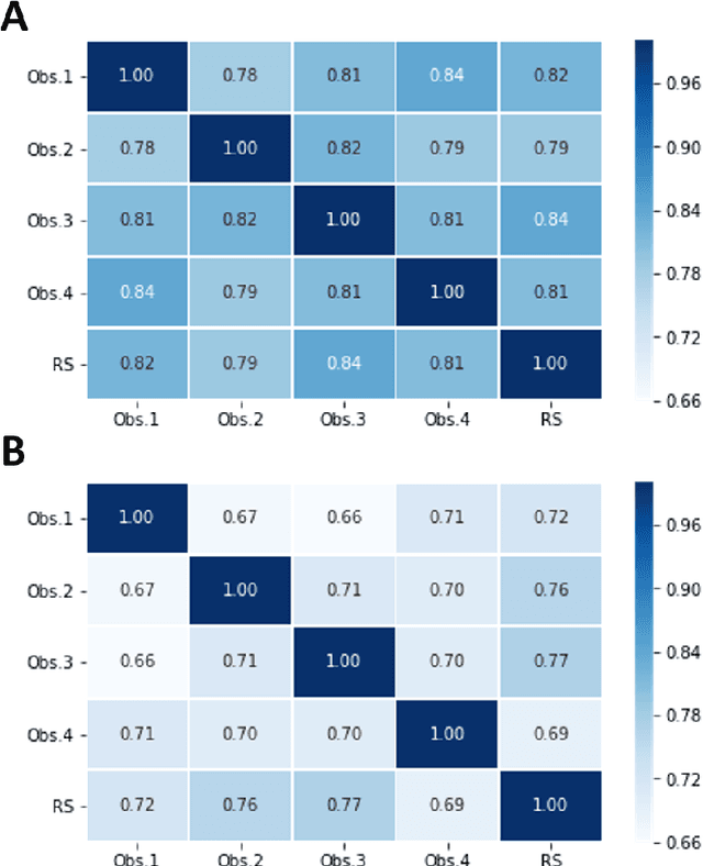 Figure 4 for Evaluation of a deep learning system for the joint automated detection of diabetic retinopathy and age-related macular degeneration