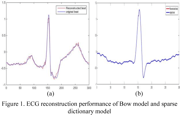 Figure 1 for ECG beats classification via online sparse dictionary and time pyramid matching