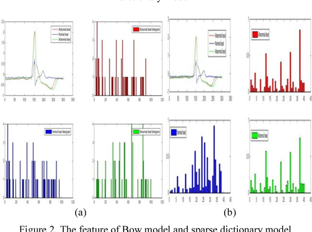 Figure 2 for ECG beats classification via online sparse dictionary and time pyramid matching