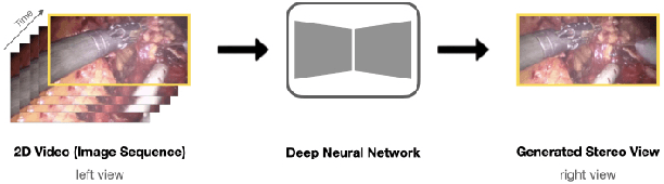 Figure 3 for Stereo Video Reconstruction Without Explicit Depth Maps for Endoscopic Surgery
