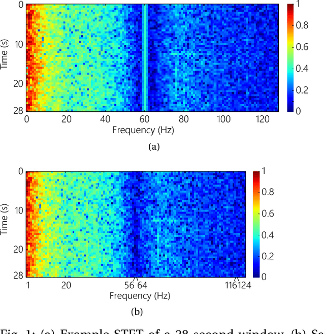 Figure 1 for Semi-supervised Seizure Prediction with Generative Adversarial Networks