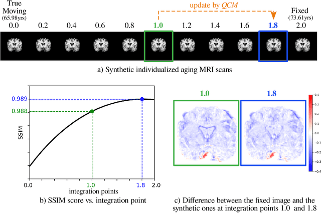 Figure 3 for Generative Aging of Brain Images with Diffeomorphic Registration