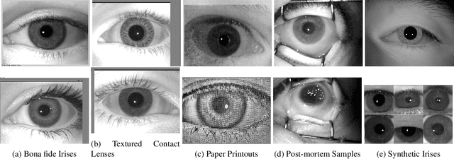 Figure 1 for Iris Presentation Attack Detection: Where Are We Now?