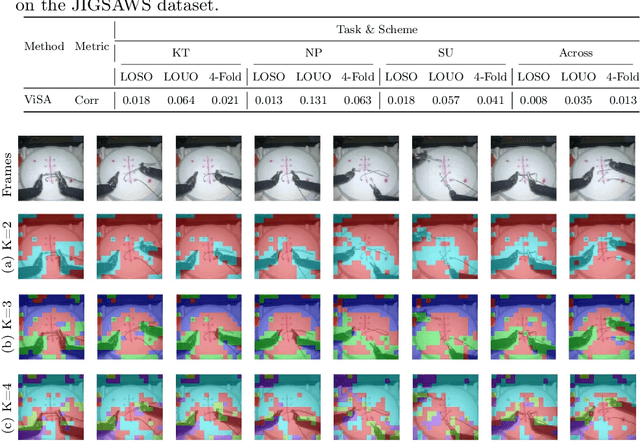 Figure 4 for Surgical Skill Assessment via Video Semantic Aggregation