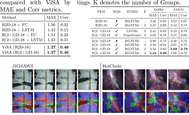 Figure 3 for Surgical Skill Assessment via Video Semantic Aggregation