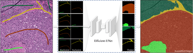 Figure 1 for Robust Interactive Semantic Segmentation of Pathology Images with Minimal User Input