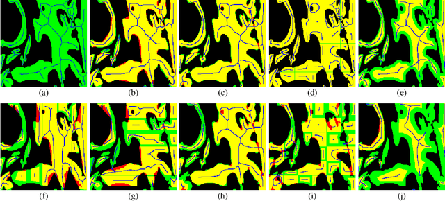 Figure 3 for Robust Interactive Semantic Segmentation of Pathology Images with Minimal User Input