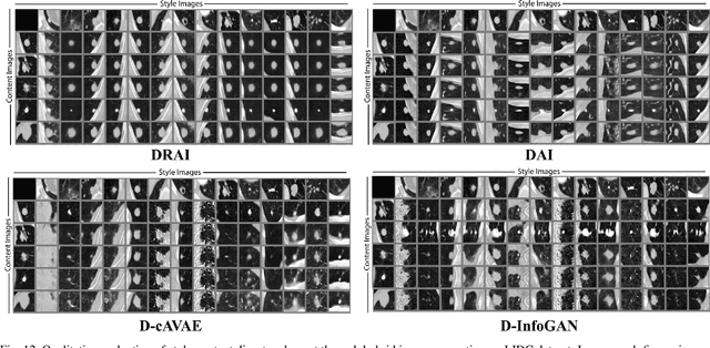 Figure 4 for Conditional Generation of Medical Images via Disentangled Adversarial Inference