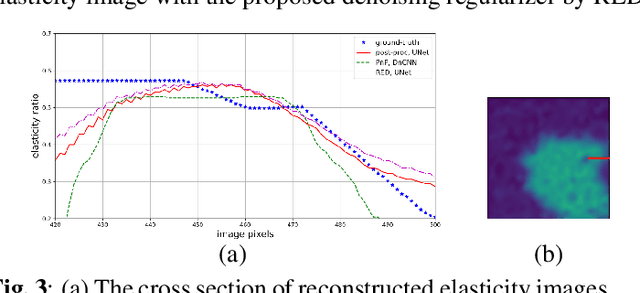 Figure 3 for MR elasticity reconstruction using statistical physical modeling and explicit data-driven denoising regularizer