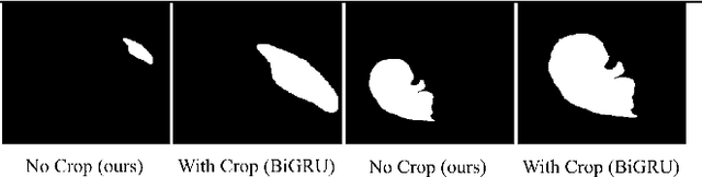 Figure 3 for Robust Prototypical Few-Shot Organ Segmentation with Regularized Neural-ODEs