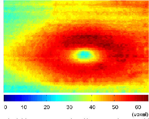 Figure 3 for A 3D Segmentation Method for Retinal Optical Coherence Tomography Volume Data