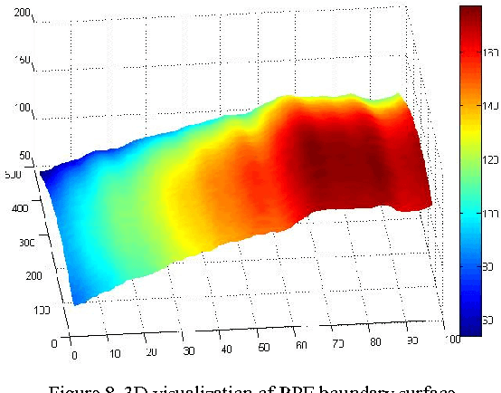 Figure 4 for A 3D Segmentation Method for Retinal Optical Coherence Tomography Volume Data