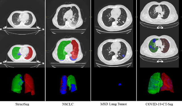 Figure 1 for Towards Efficient COVID-19 CT Annotation: A Benchmark for Lung and Infection Segmentation