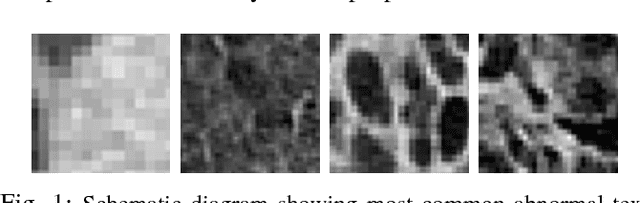 Figure 1 for Near-optimal Keypoint Sampling for Fast Pathological Lung Segmentation