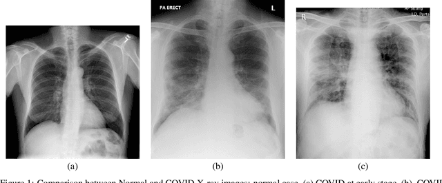 Figure 1 for Early Screening of SARS-CoV-2 by Intelligent Analysis of X-Ray Images