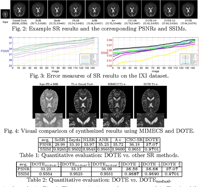 Figure 2 for DOTE: Dual cOnvolutional filTer lEarning for Super-Resolution and Cross-Modality Synthesis in MRI