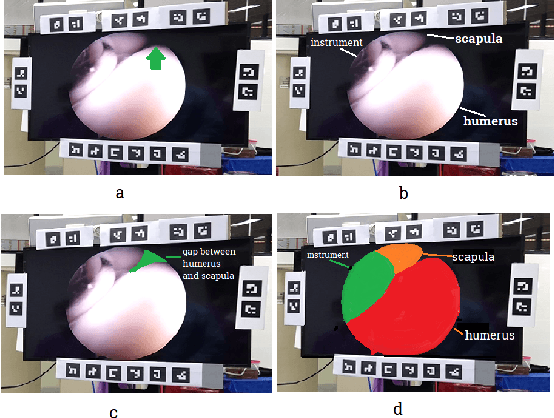 Figure 3 for States of confusion: Eye and Head tracking reveal surgeons' confusion during arthroscopic surgery