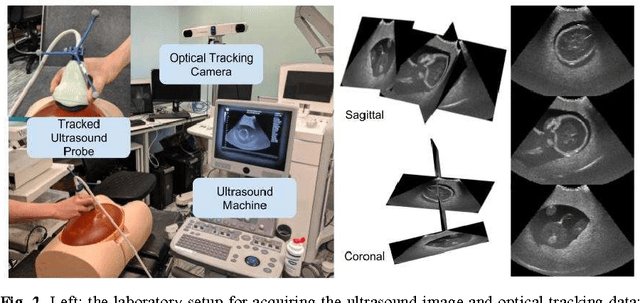Figure 2 for Freehand Ultrasound Image Simulation with Spatially-Conditioned Generative Adversarial Networks