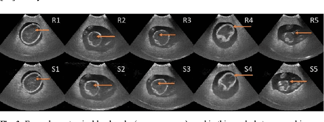 Figure 3 for Freehand Ultrasound Image Simulation with Spatially-Conditioned Generative Adversarial Networks