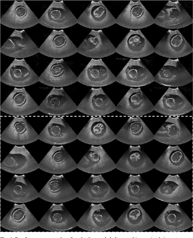 Figure 4 for Freehand Ultrasound Image Simulation with Spatially-Conditioned Generative Adversarial Networks