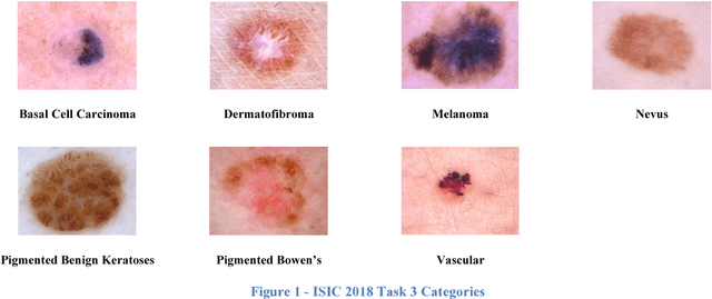 Figure 1 for A Dense CNN approach for skin lesion classification