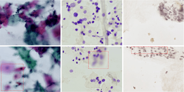 Figure 1 for What is the State of the Art of Computer Vision-Assisted Cytology? A Systematic Literature Review