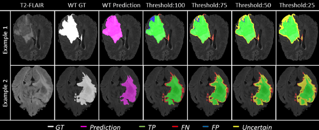 Figure 2 for QU-BraTS: MICCAI BraTS 2020 Challenge on Quantifying Uncertainty in Brain Tumor Segmentation -- Analysis of Ranking Metrics and Benchmarking Results