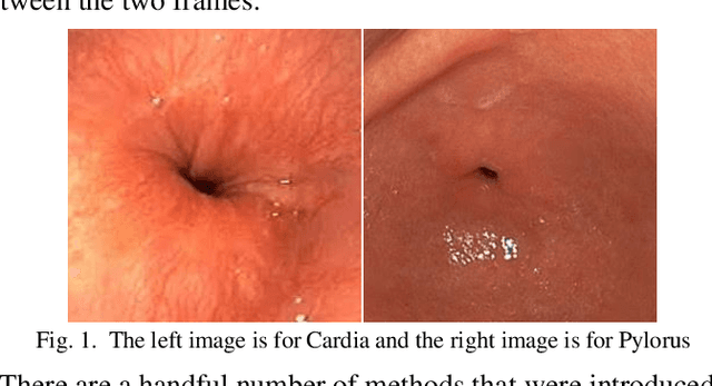 Figure 1 for Siamese Network Features for Endoscopy Image and Video Localization