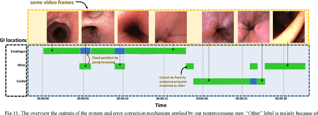 Figure 3 for Siamese Network Features for Endoscopy Image and Video Localization