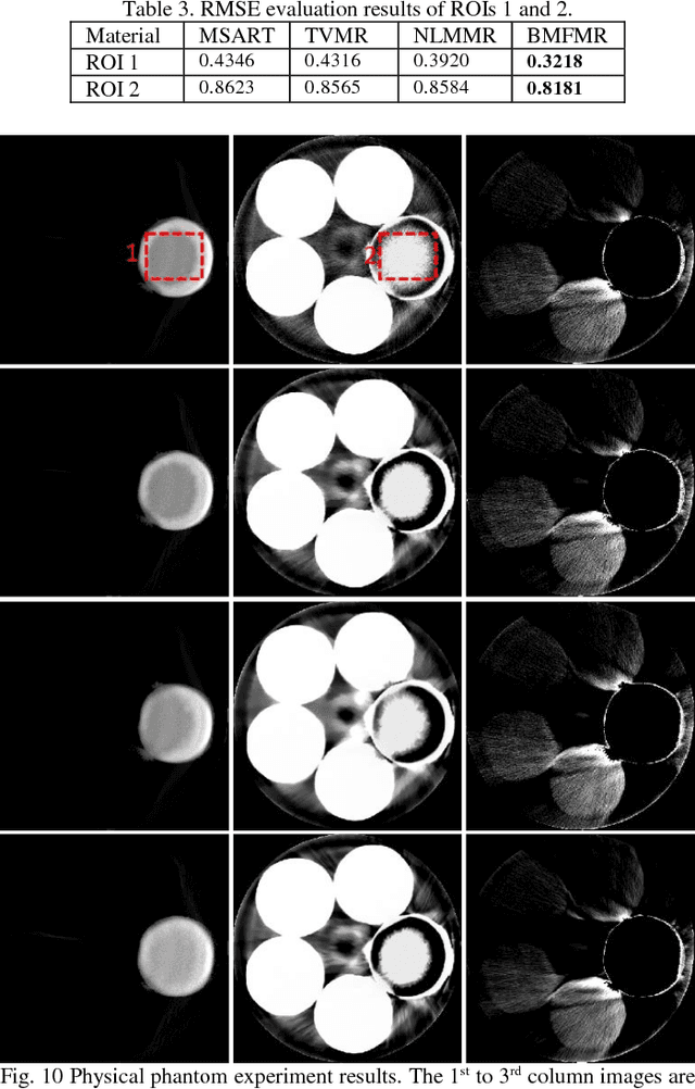 Figure 4 for Block Matching Frame based Material Reconstruction for Spectral CT