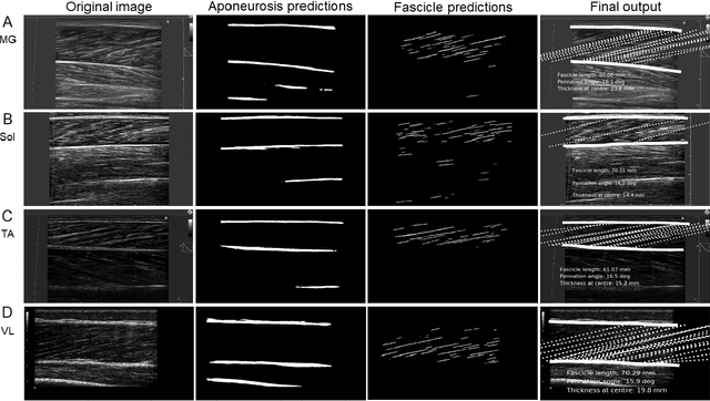 Figure 4 for Fully automated analysis of muscle architecture from B-mode ultrasound images with deep learning