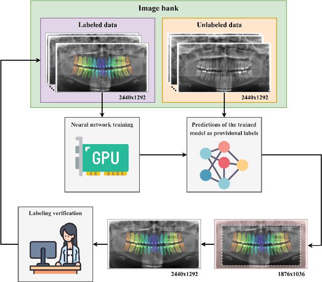 Figure 1 for OdontoAI: A human-in-the-loop labeled data set and an online platform to boost research on dental panoramic radiographs
