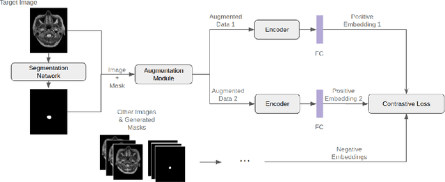 Figure 1 for Triplet Contrastive Learning for Brain Tumor Classification