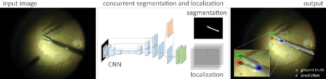 Figure 1 for Concurrent Segmentation and Localization for Tracking of Surgical Instruments