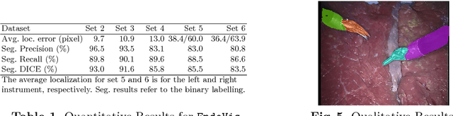 Figure 2 for Concurrent Segmentation and Localization for Tracking of Surgical Instruments