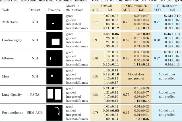 Figure 2 for Gifsplanation via Latent Shift: A Simple Autoencoder Approach to Progressive Exaggeration on Chest X-rays
